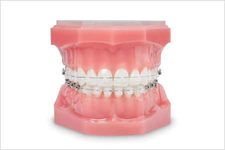 鳴尾・武庫川で歯列矯正治療なら「つかさ歯科クリニック」